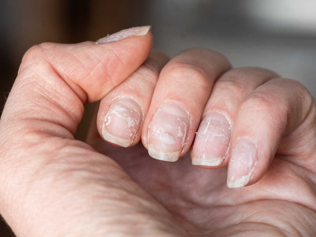 Comment réparer ses ongles après des faux ongles ?