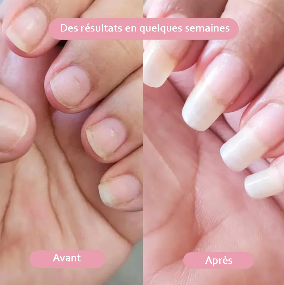 Sérum Keranailz pour ongles - Croissance & Renforcement
